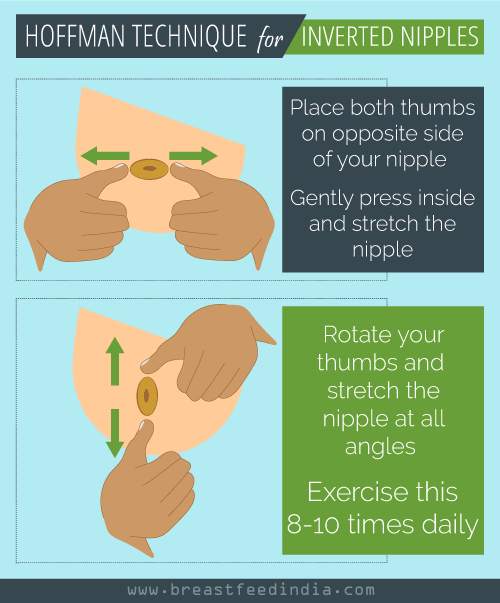 Rolling nipples technique
