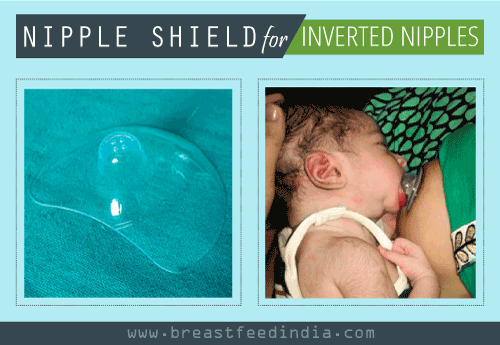 Nipple shield